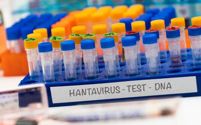 What is hantavirus and should you be worried? 